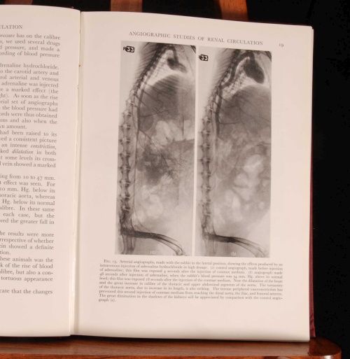 1947 Studies in Renal Circulation Medicine 1st D J